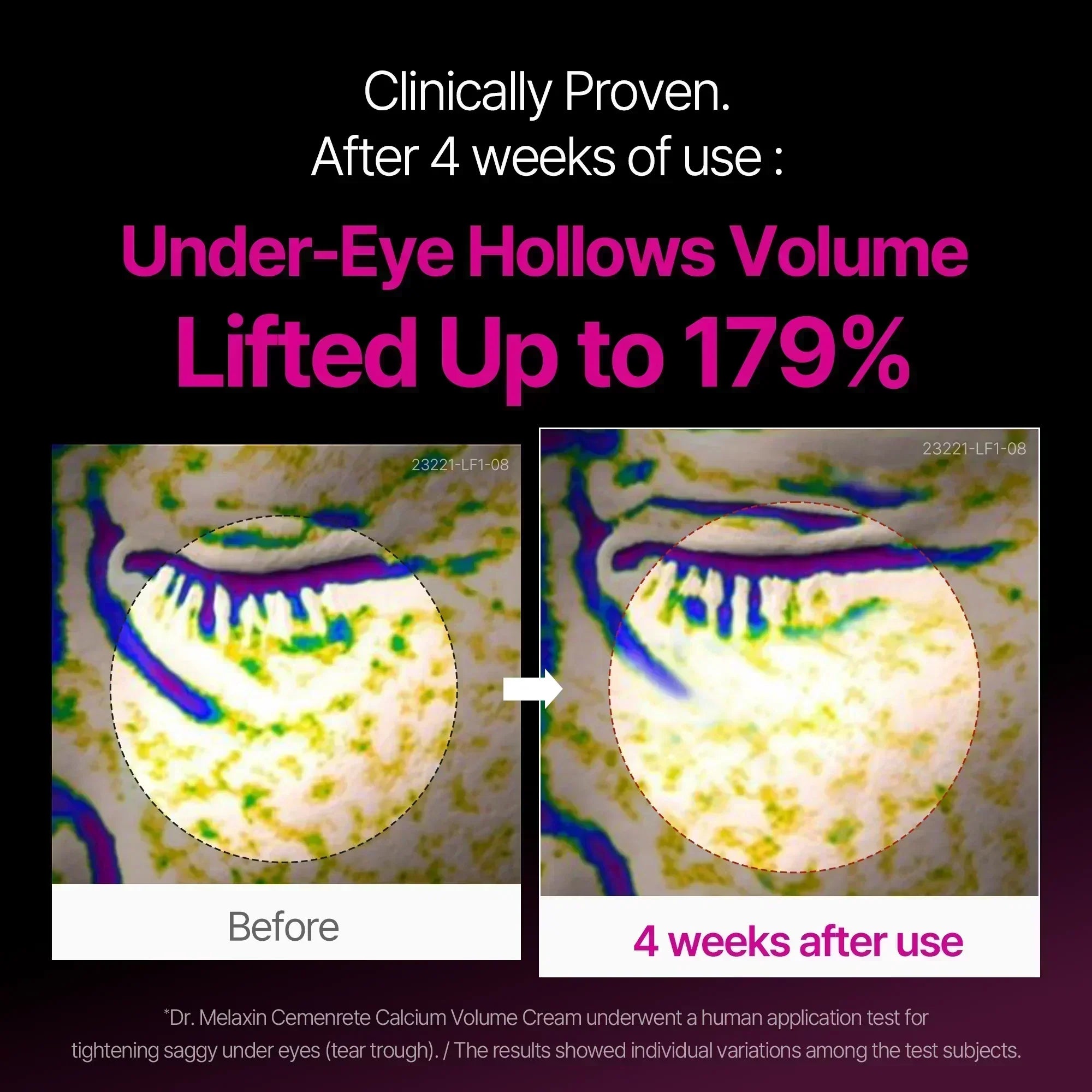 Cemenrete Calcium Intense Cream